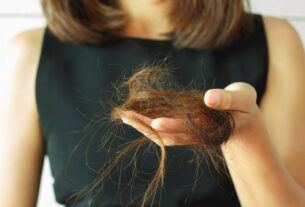 Queda de Cabelo Relacionada ao Estresse