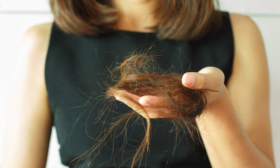 Queda de Cabelo Relacionada ao Estresse
